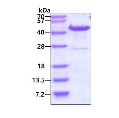 SDS-PAGE: Recombinant Human DNAJB6 His Protein [NBP1-50943]